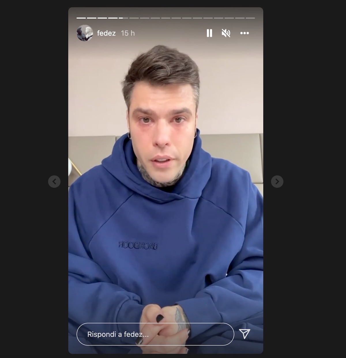 fedez malattia intervento operazione indiscrezioni