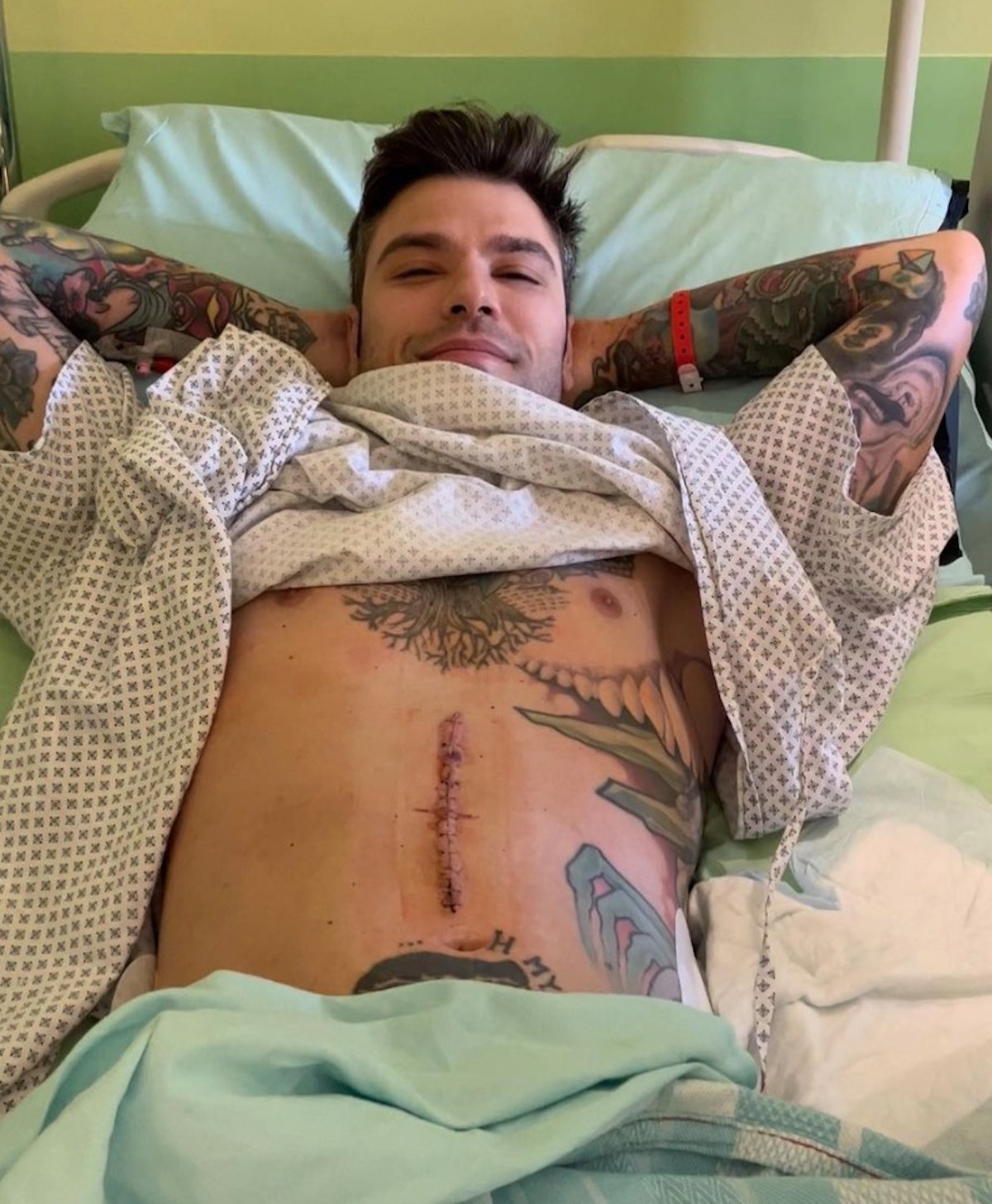 fedez tumore pancreas medico