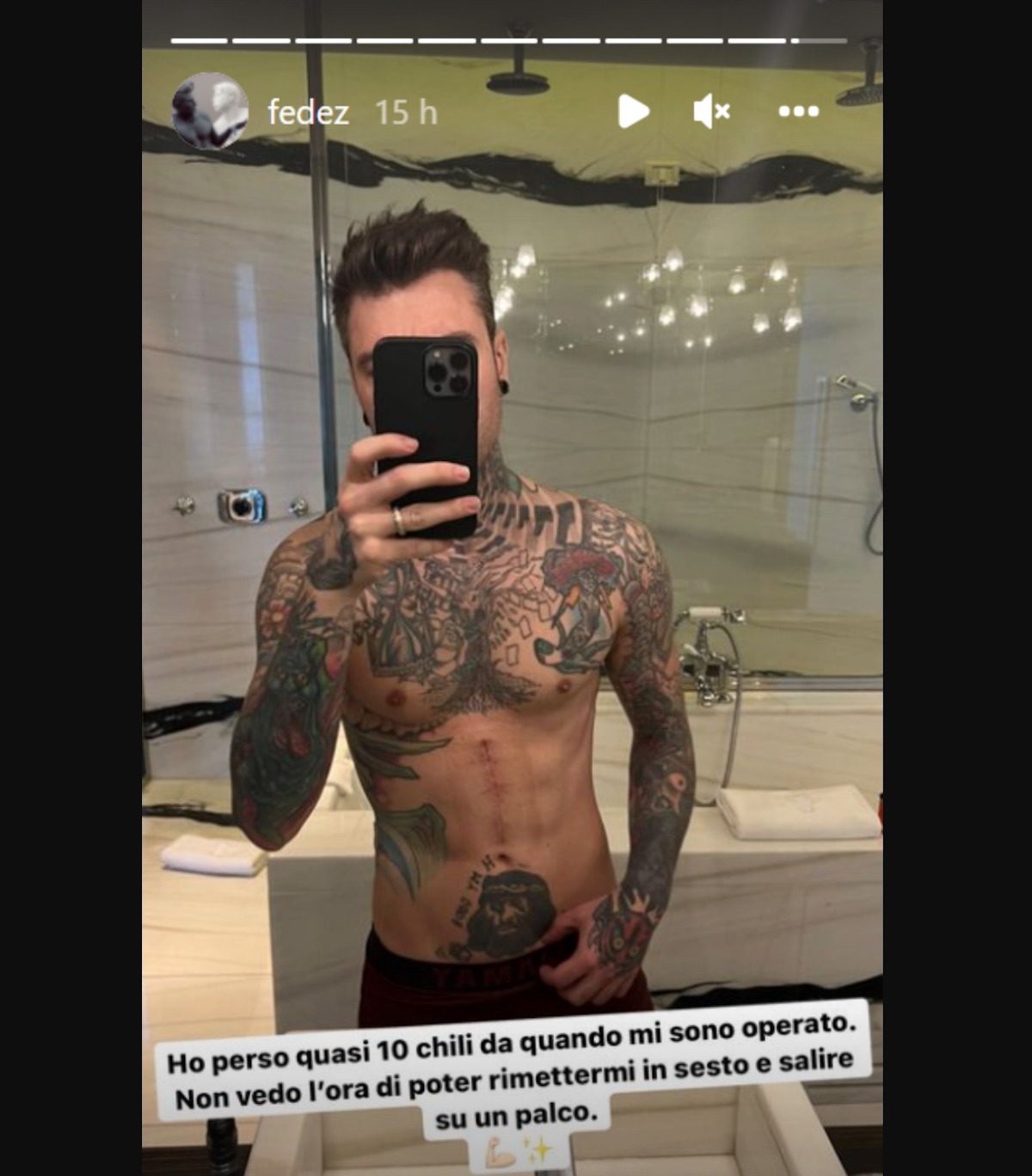 fedez foto corpo dimagrito intervento