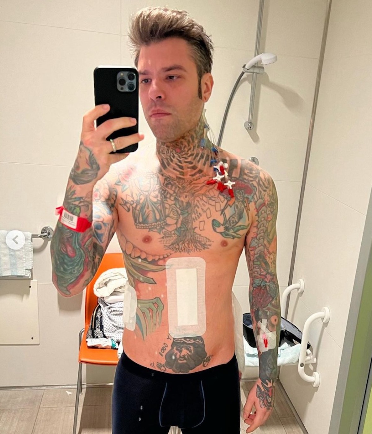 fedez malattia tumore intervento esame istologico